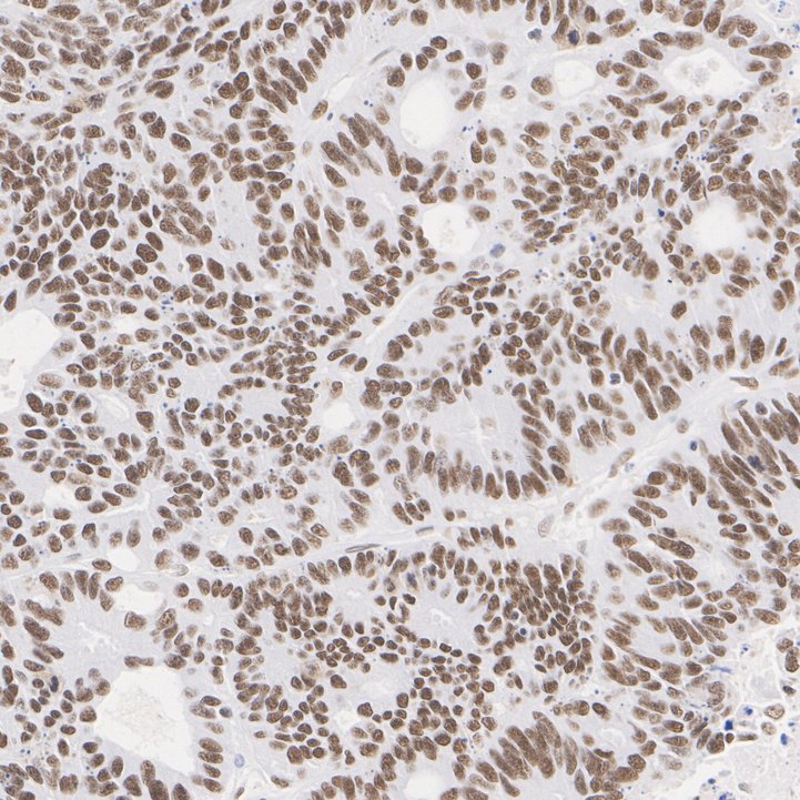 ADNP antibody product image